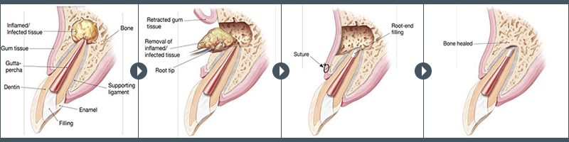 Endodontic-Surgery-800-x-200-PX